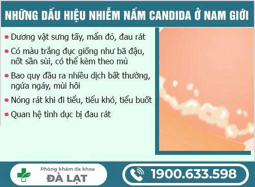 Hình ảnh minh họa